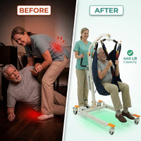 Collapsible Electric Patient Lift, Floor Lift Assist for Elderly, Medical Transfer Device with 440LBS Capacity,Portable & Easy Assembly — Before & After